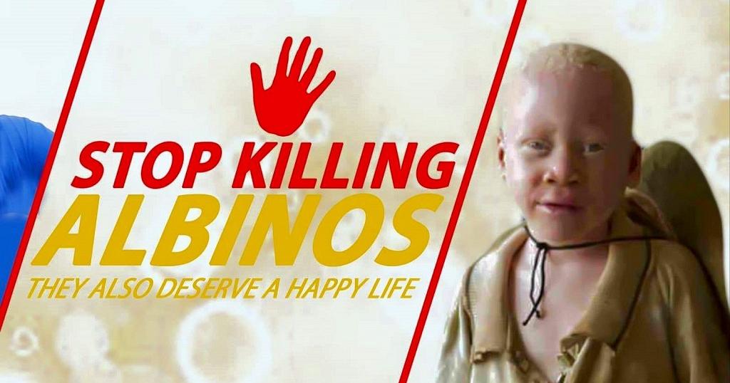 King viper - Stop albinism killing Featuring Snaymoney Hennessy